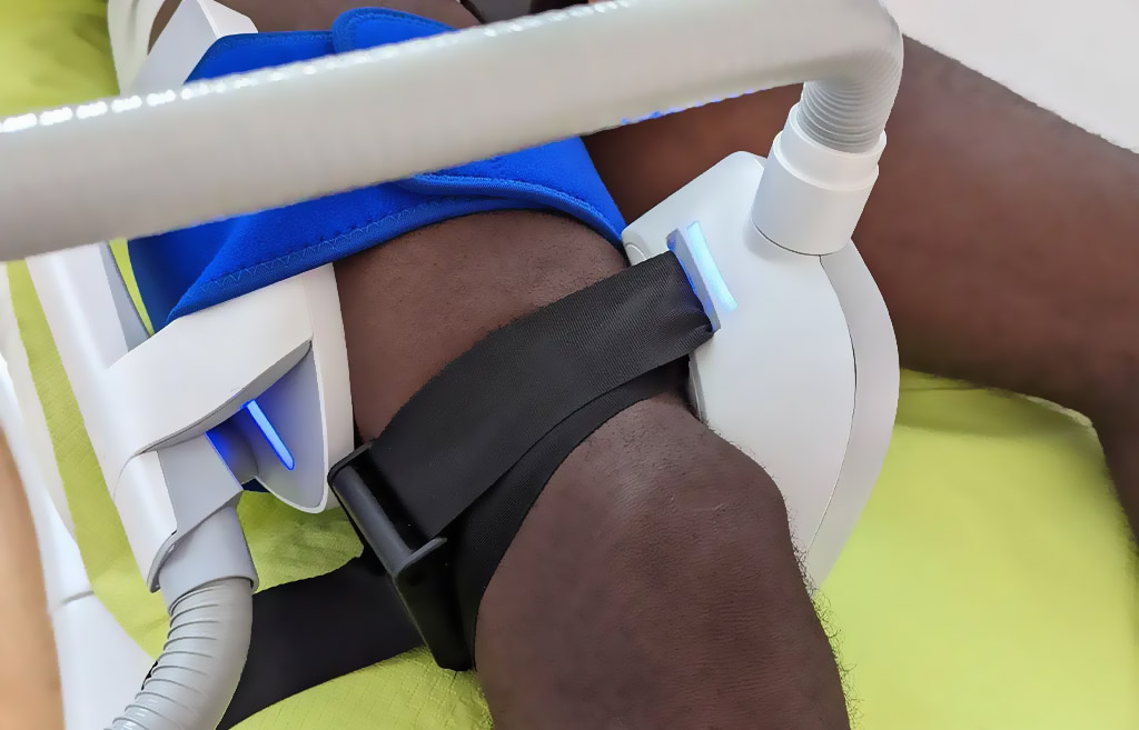 Eine Person mit dunkelbrauner Haut erhält eine medizinische Behandlung am Knie